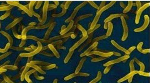 微生物菌劑好？好在哪里您知道嗎？